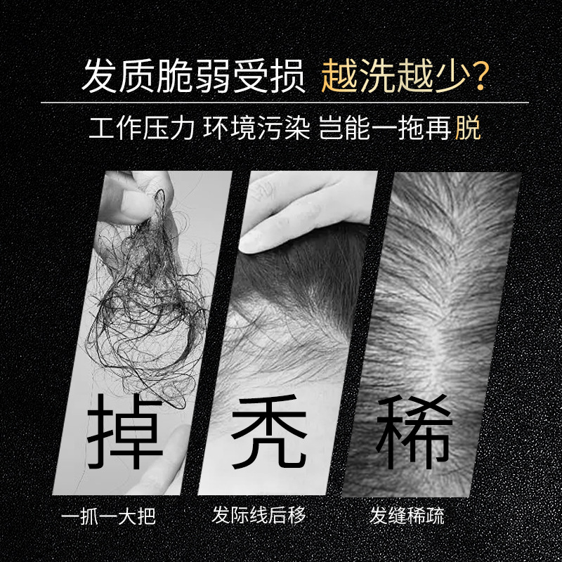 Famulan Anti Hair Loss Shampoo - đánh giá và giá Hair Care Normal
