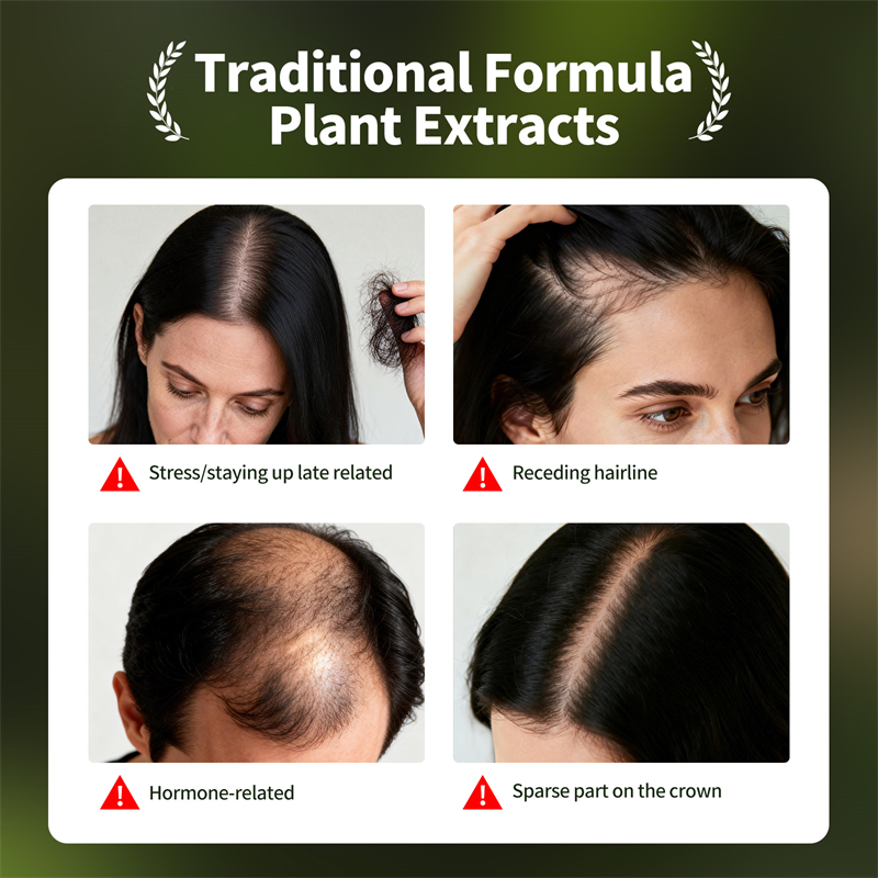 Natural Hair Growth Set Usman  - đánh giá và giá Hair Care Natural Products