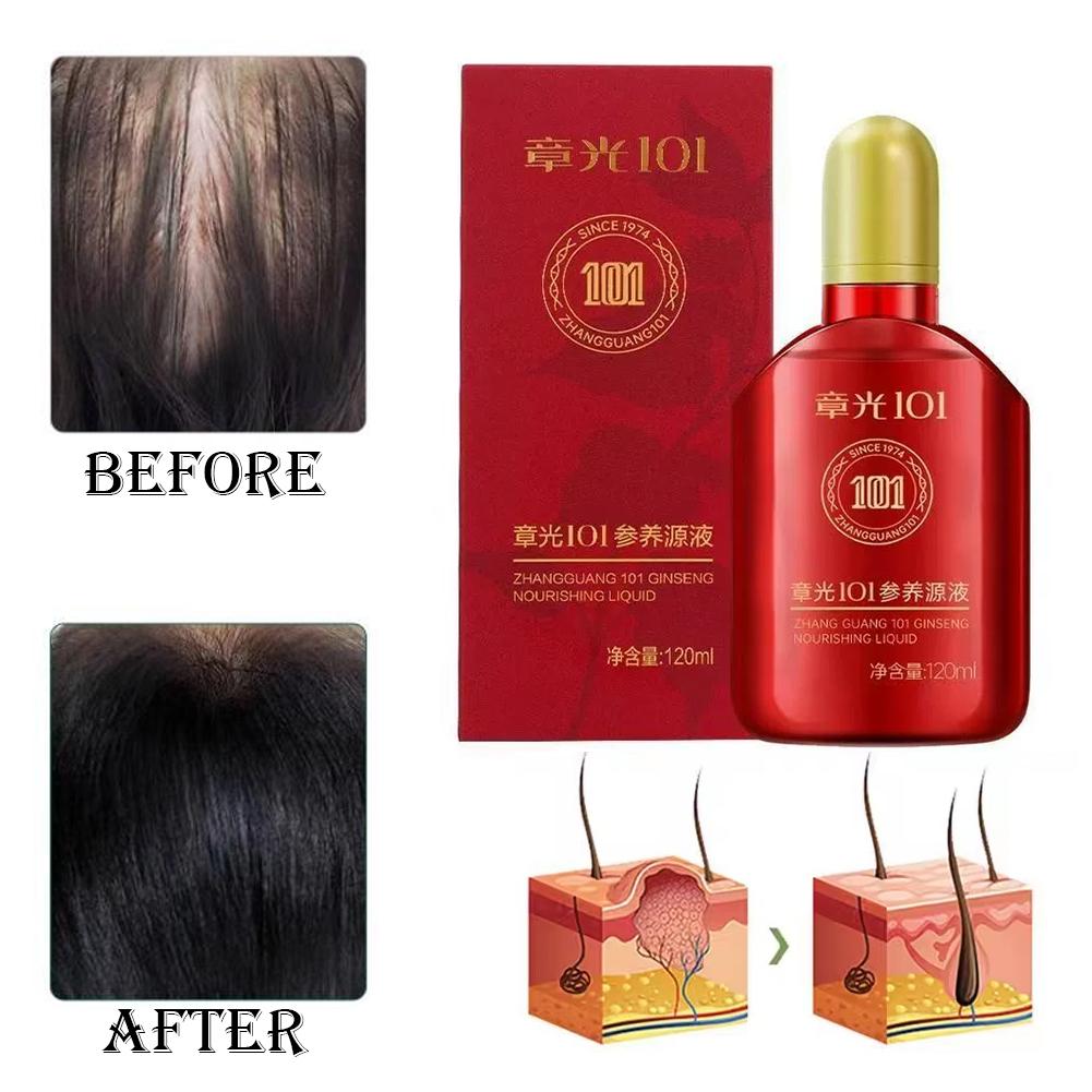 Zhang Guang 101 formula (101P) - đánh giá và giá Hair Care Normal