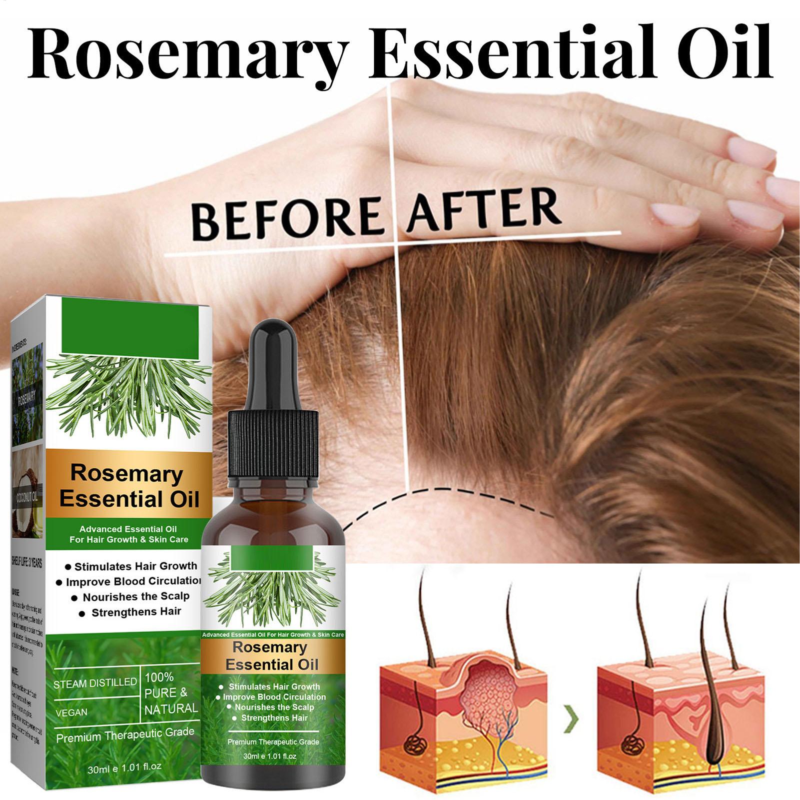 Rosemary Essential Oil Hair Gr - đánh giá và giá Hair Care Natural Products